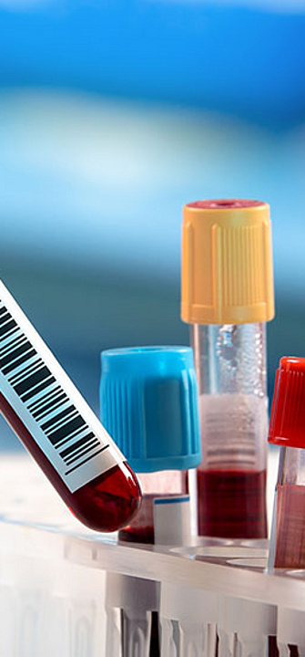 Blut - Credit: angellodeco/AdobeStock