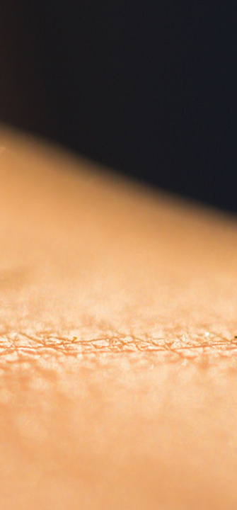 Mücke / AdobeStock - Lab_Photo