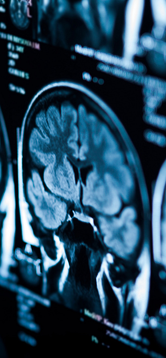 Tomographiebilder eines Gehirns