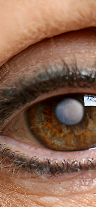 Grauer Star / © Africa Studio/adobe.stock.com