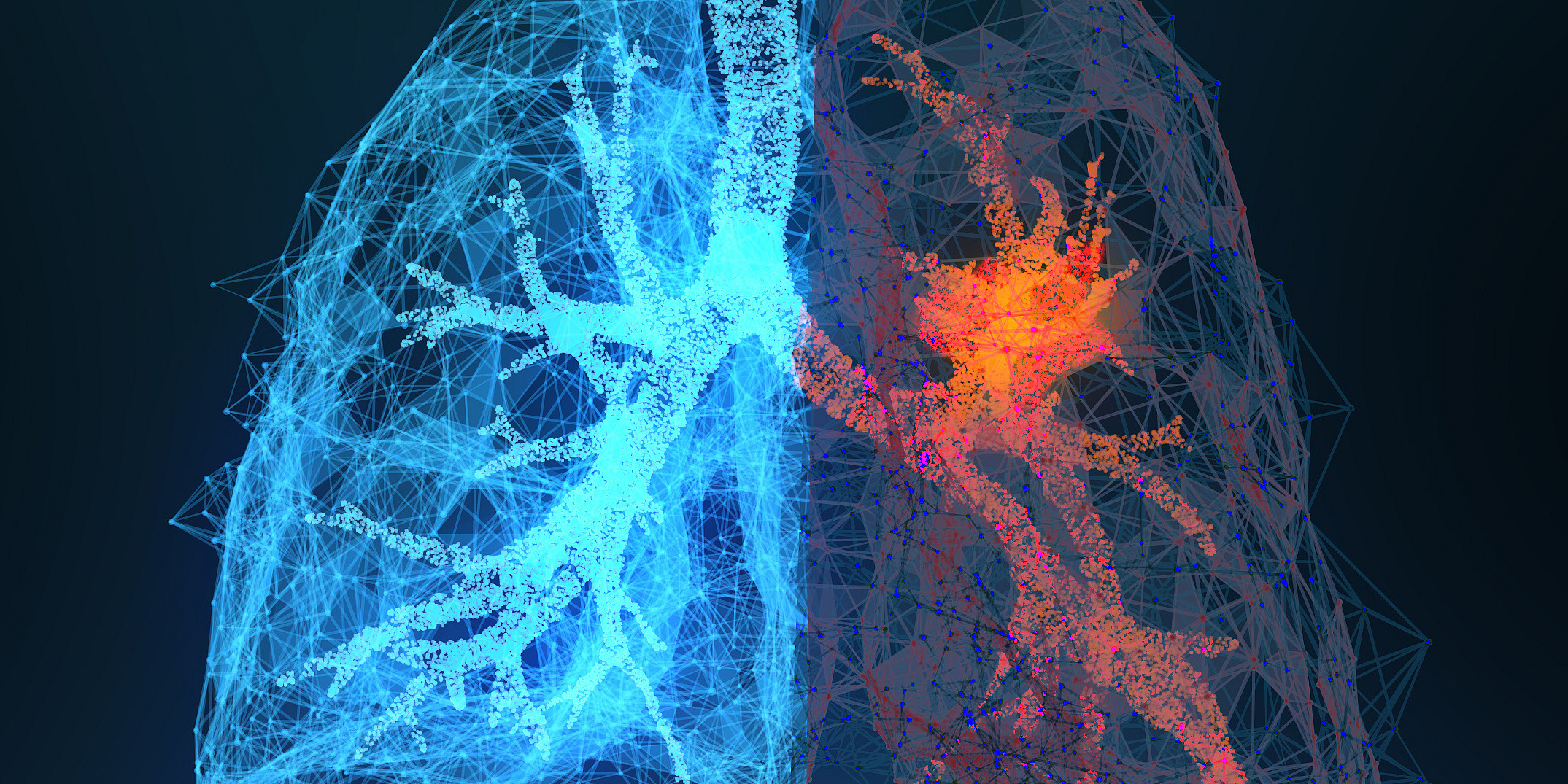 3D-gerenderte Illustration von Lungenkrebs