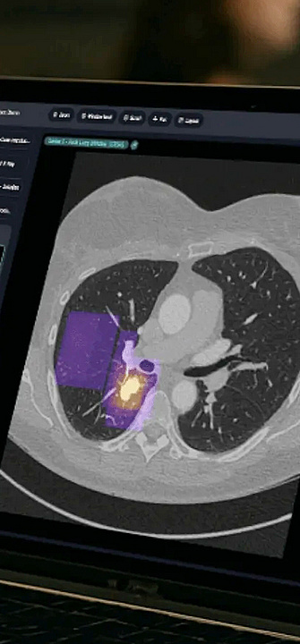 Lehre Kinderradiologie