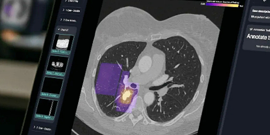 Lehre Kinderradiologie