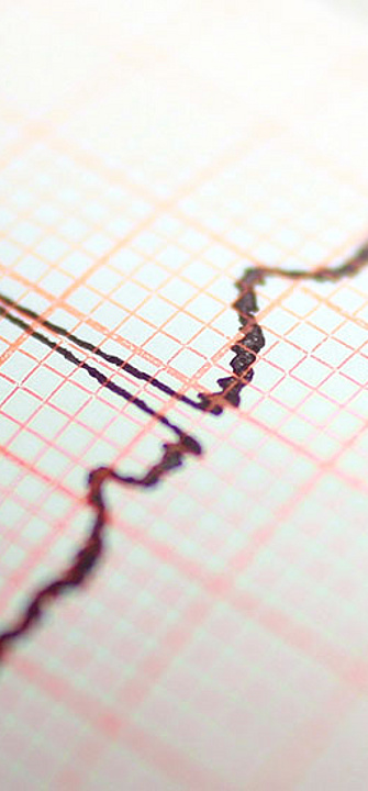 EKG - AdobeStock/emeraldfoto