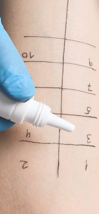 Allergietest - Foto: New Africa/AdobeStock.com