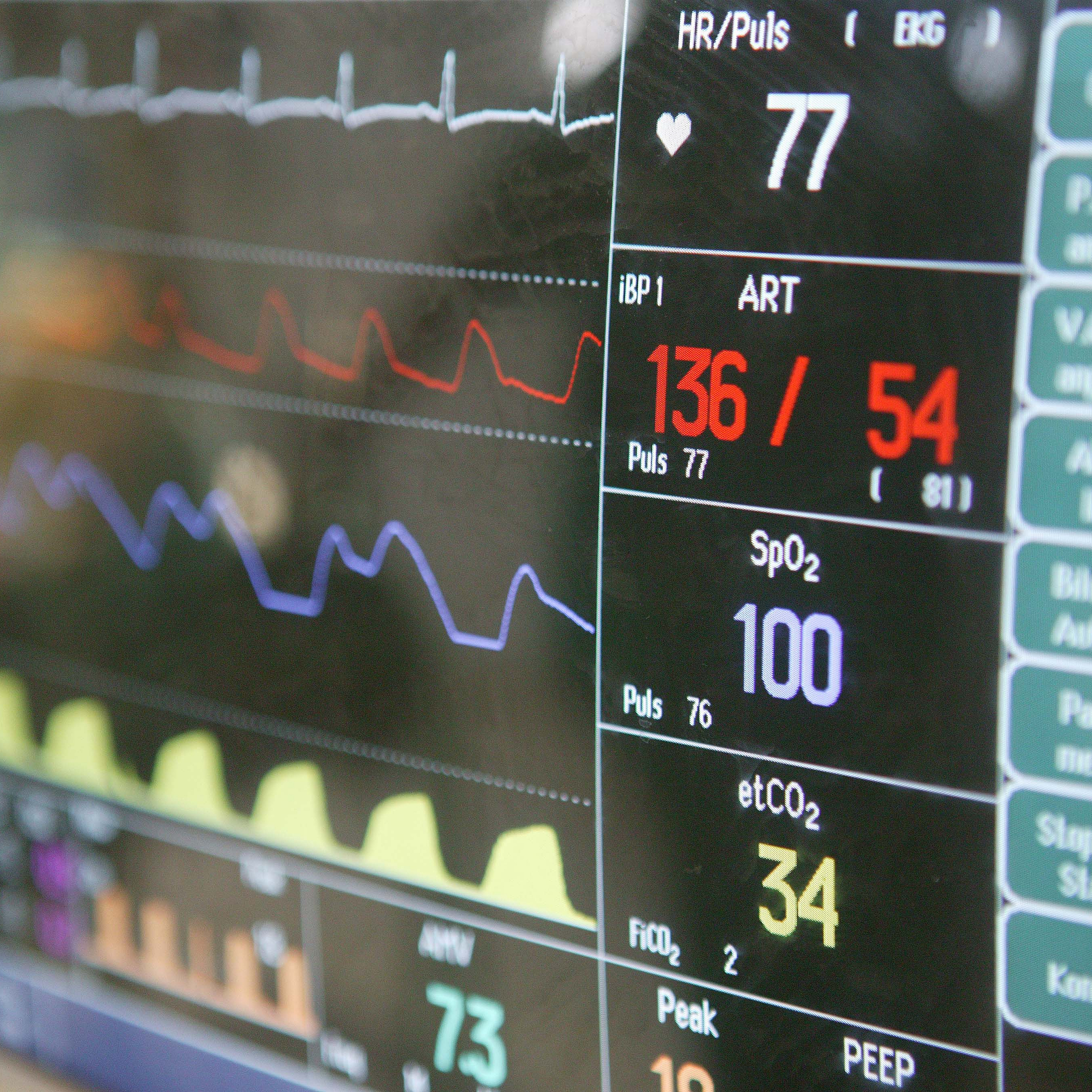 Auf einem Monitor werden Vitalzeichen wie Puls, Suaerstoffsättigung und Blutdruck angezeigt.