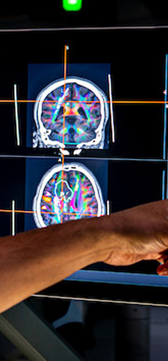 Projekt nARvibrain - Copyright: FH JOANNEUM GmbH & Med Uni Graz