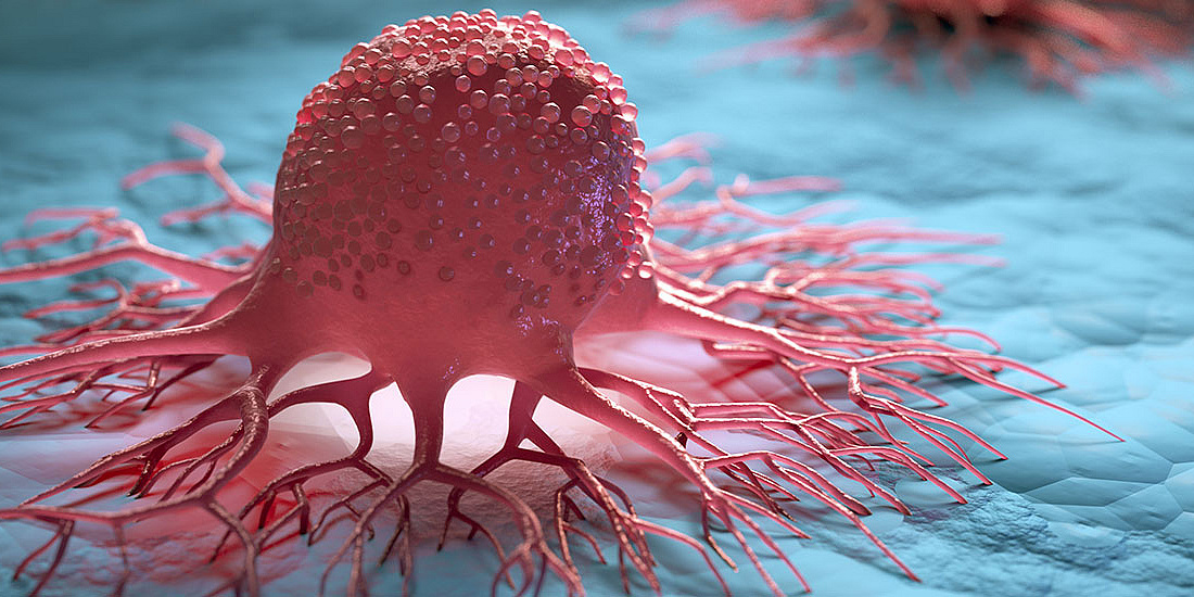 Krebs - Credit: AdobeStock/peterschreiber.media