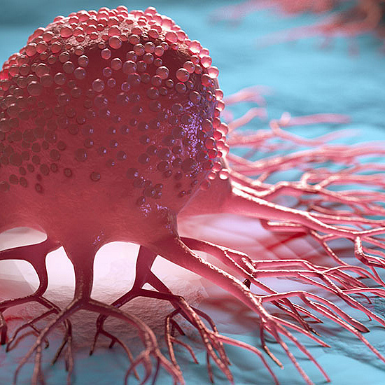 Krebs - AdobeStock/peterschreiber.media