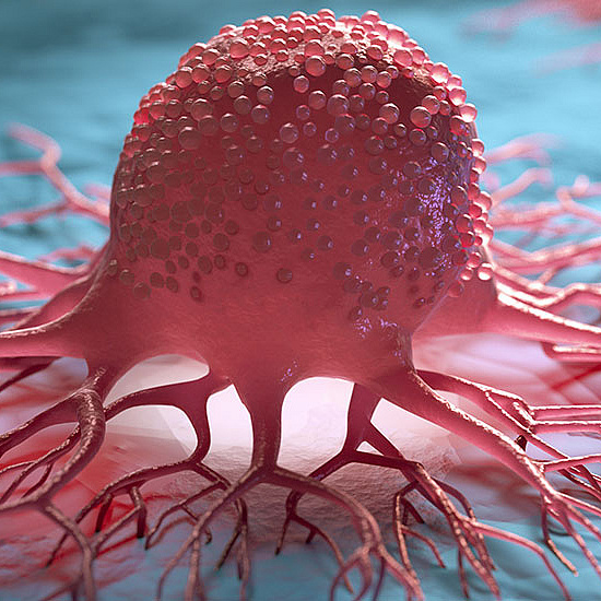 Krebs - Credit: AdobeStock/peterschreiber.media