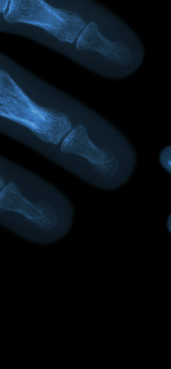 Zwei Hände im Röntgenbild
