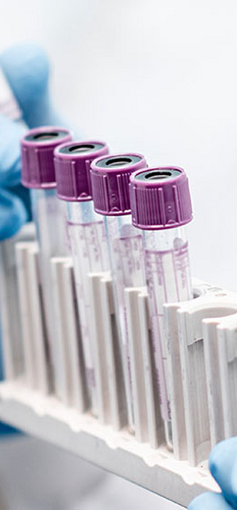 Forschung Blut - AdobeStock/rh2010