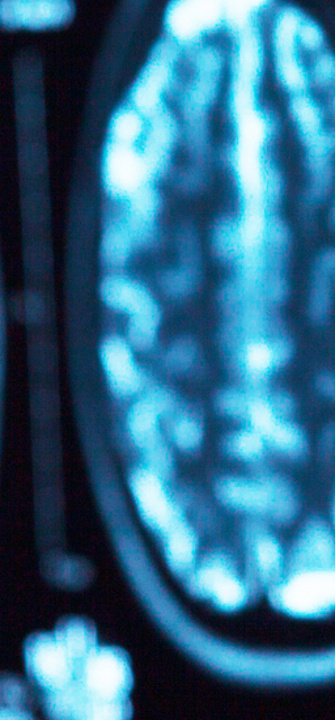 Neurologie - merydolla/AdobeStock