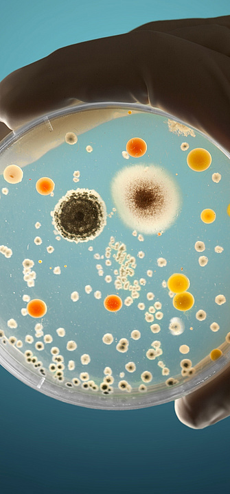 Eine Hand hält eine Petrischale, auf der eine Vielzahl unterschiedlicher Mikroorganismen wachsen