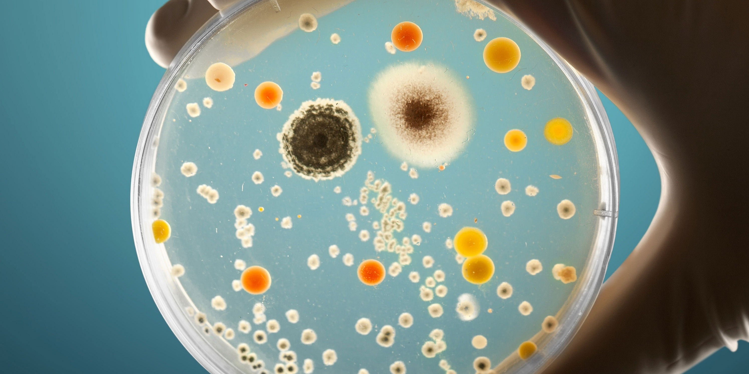 Eine Hand hält eine Petrischale, auf der eine Vielzahl unterschiedlicher Mikroorganismen wachsen
