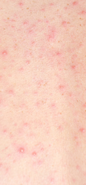 Foto: SecondSide/AdobeStock.com