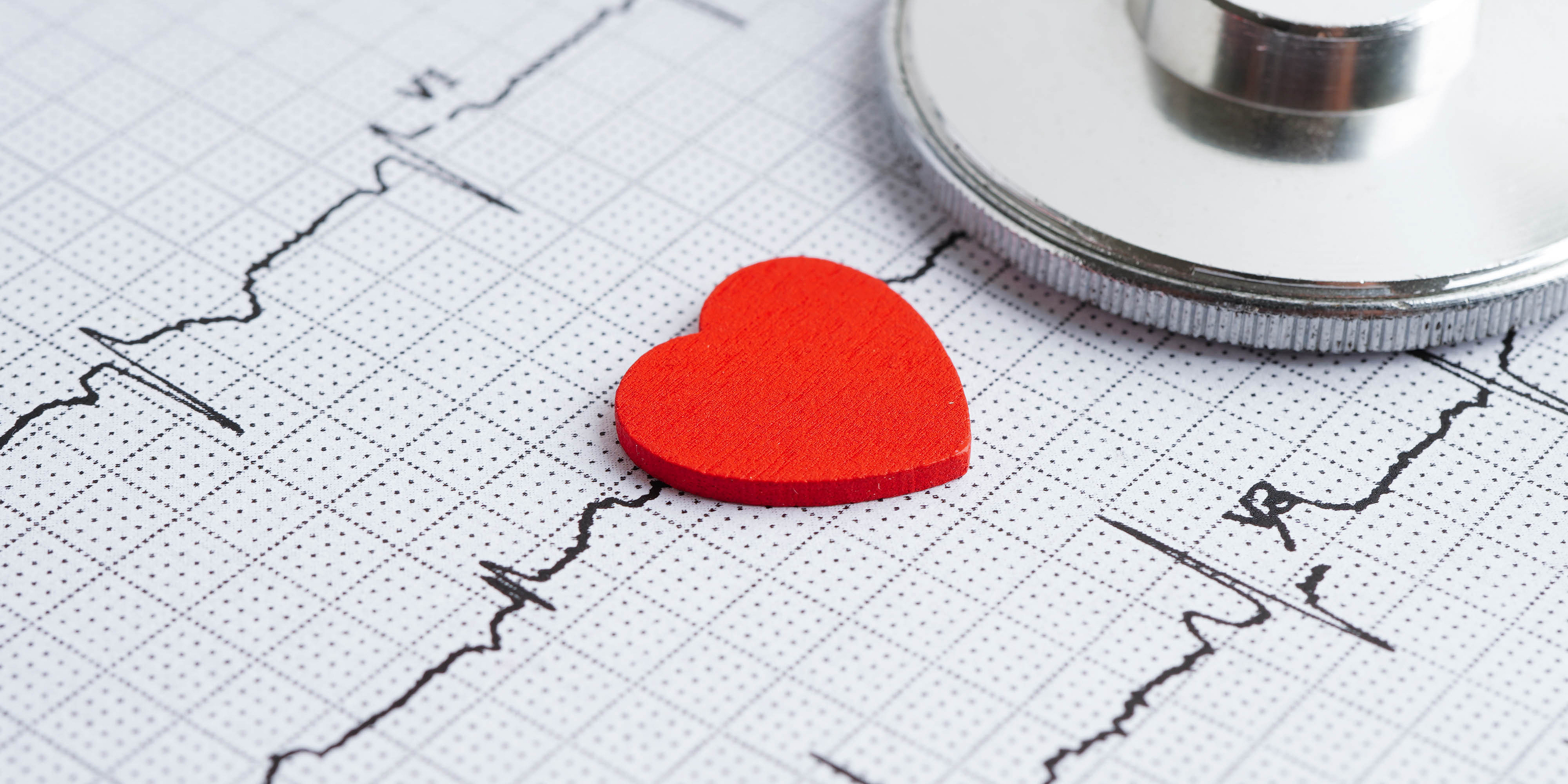 Ein Herz-Symbol liegt auf einem Ausdruck eines EKGs. Ein Stethoskop liegt in der Ecke des Bildes.