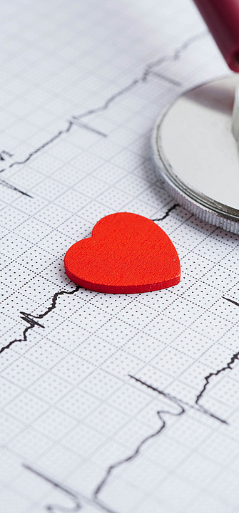 Ein Herz-Symbol liegt auf einem Ausdruck eines EKGs. Ein Stethoskop liegt in der Ecke des Bildes.