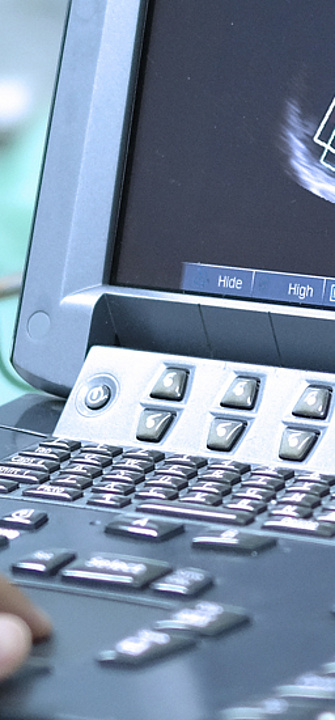 Echokardiographie - adobestock.com