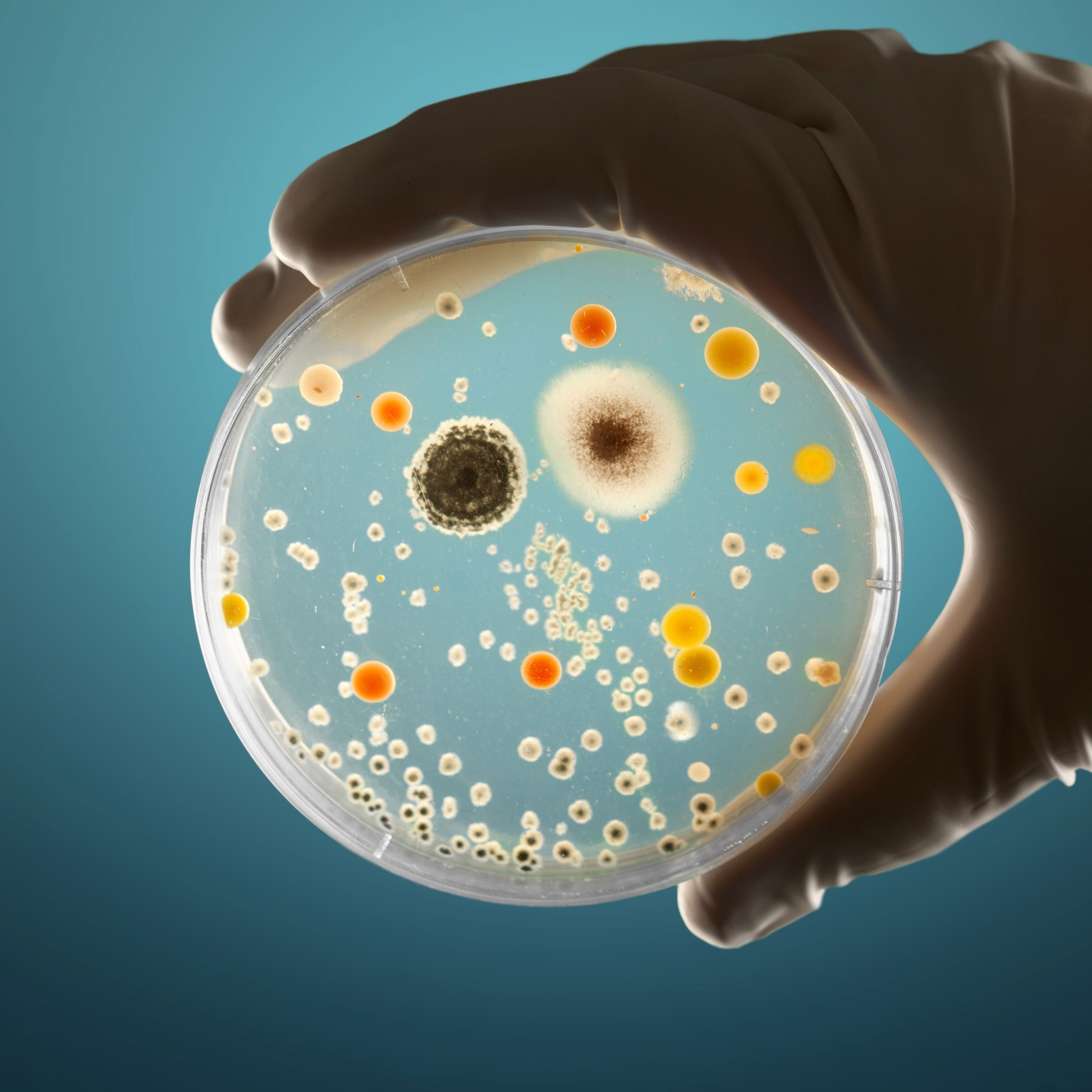 Eine Hand hält eine Petrischale, auf der eine Vielzahl unterschiedlicher Mikroorganismen wachsen