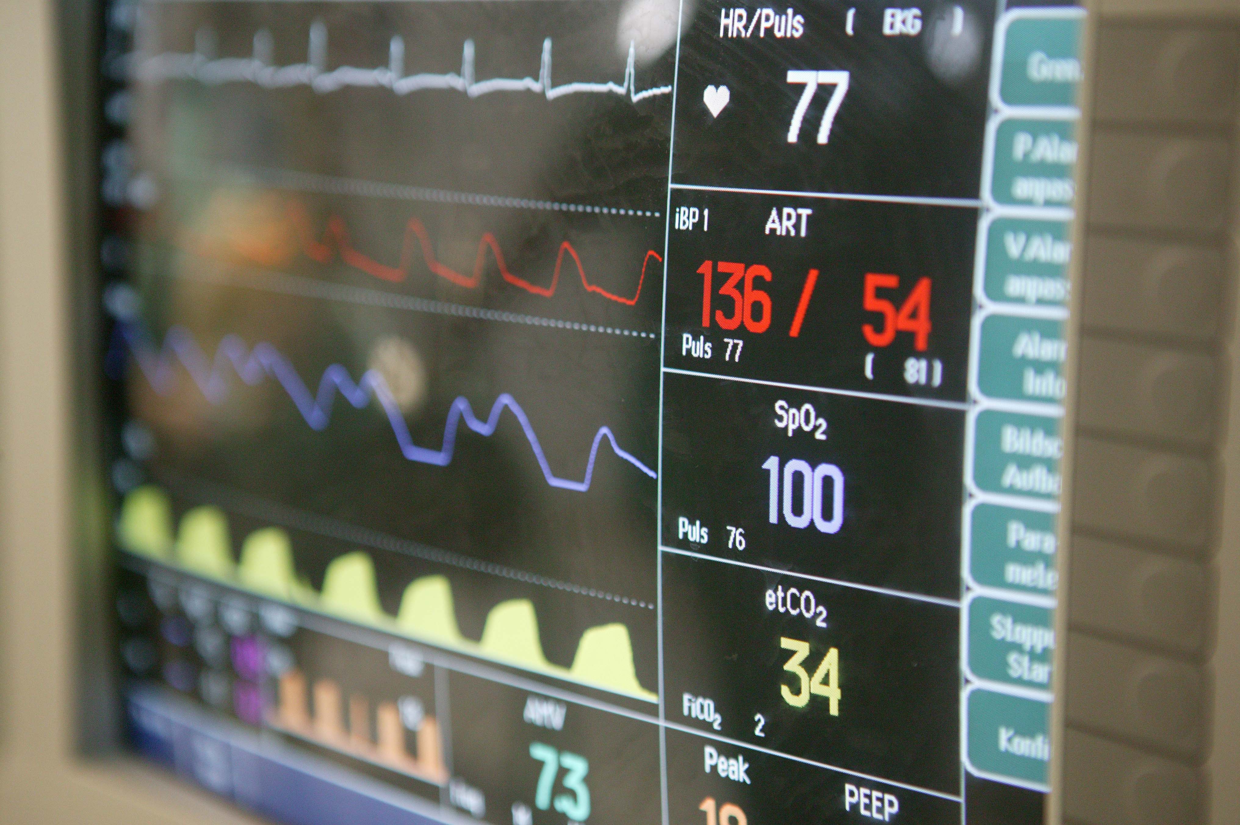 Auf einem Monitor werden Vitalzeichen wie Puls, Suaerstoffsättigung und Blutdruck angezeigt.