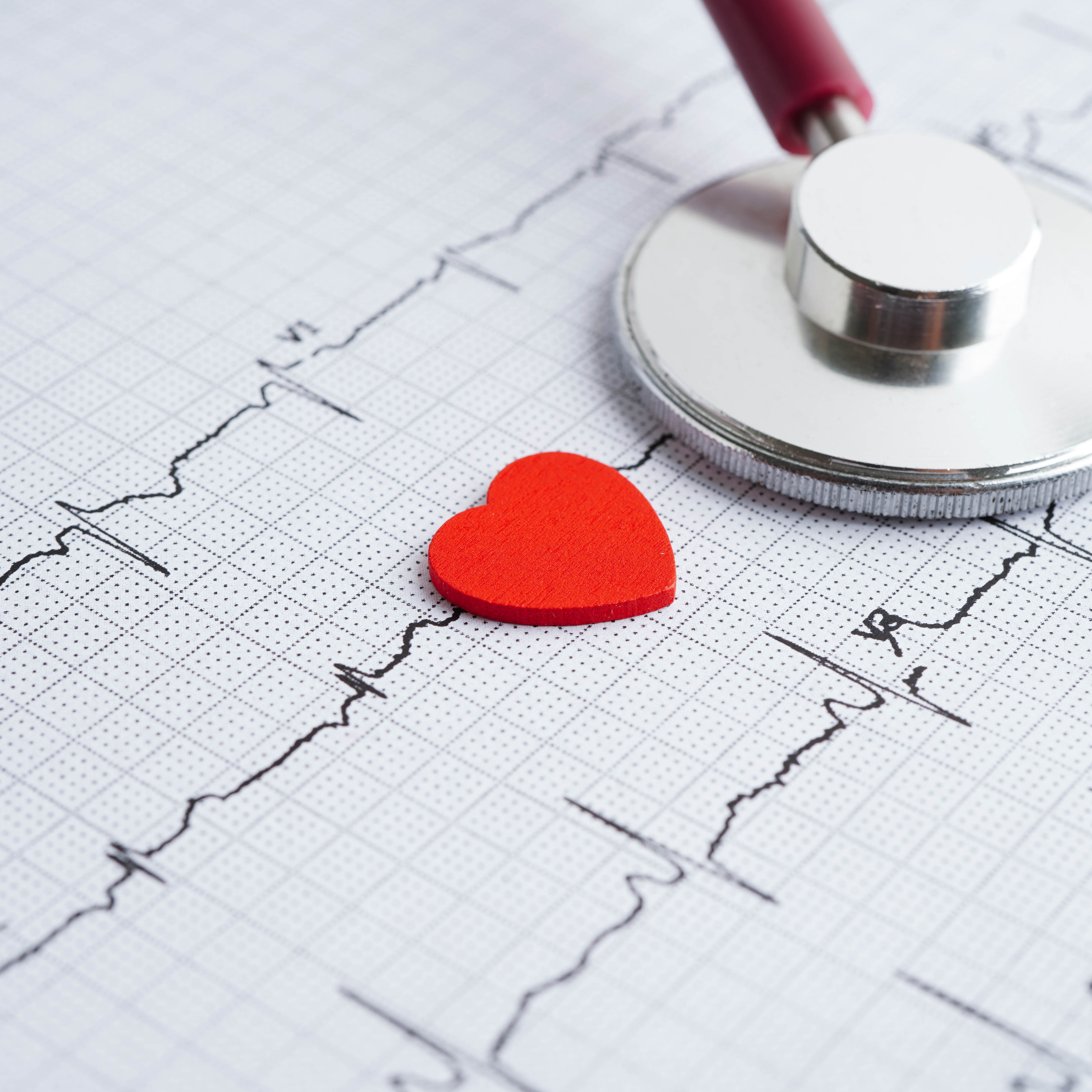 Ein Herz-Symbol liegt auf einem Ausdruck eines EKGs. Ein Stethoskop liegt in der Ecke des Bildes.