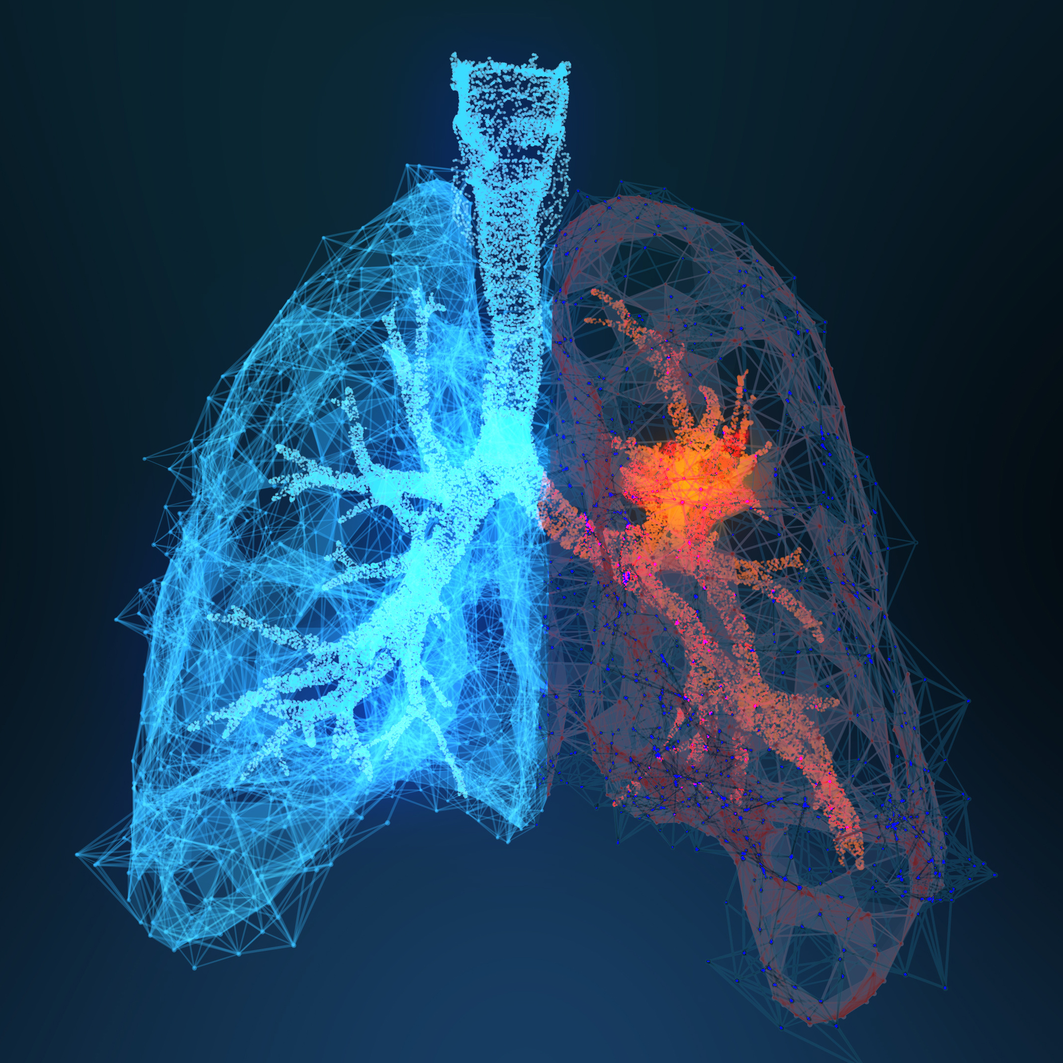 3D-gerenderte Illustration von Lungenkrebs