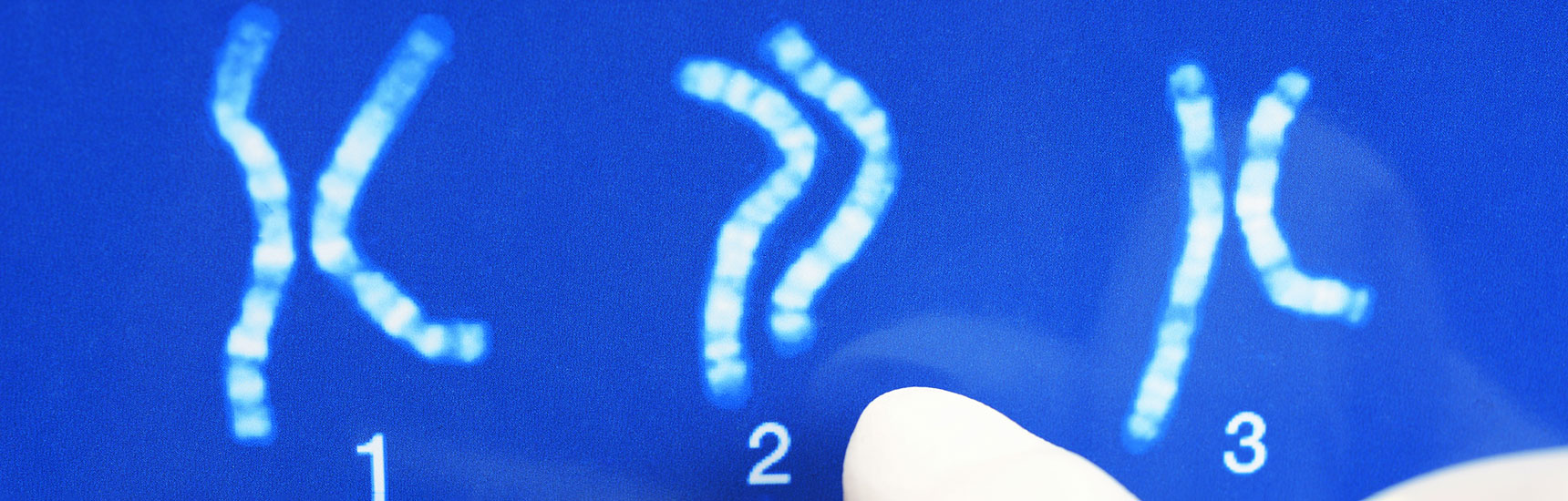 Chromosome - Dan Race/AdobeStock