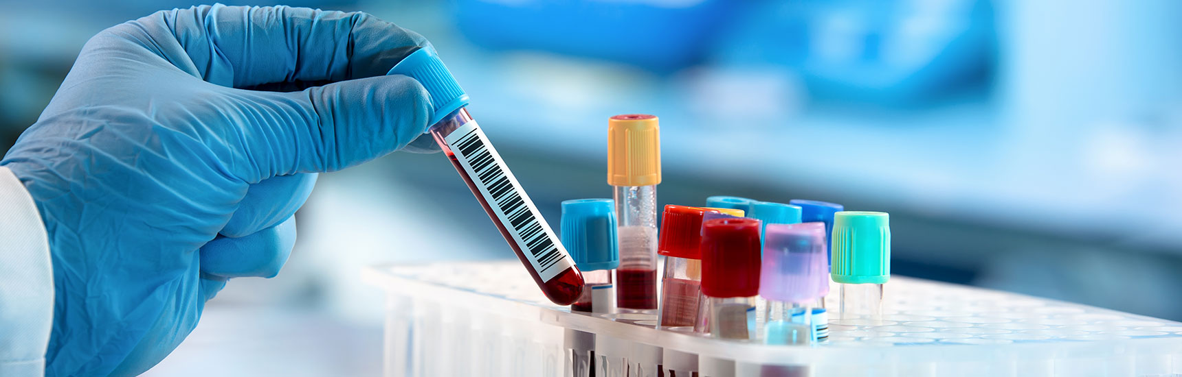 Blut im Labor - angellodeco/AdobeStock