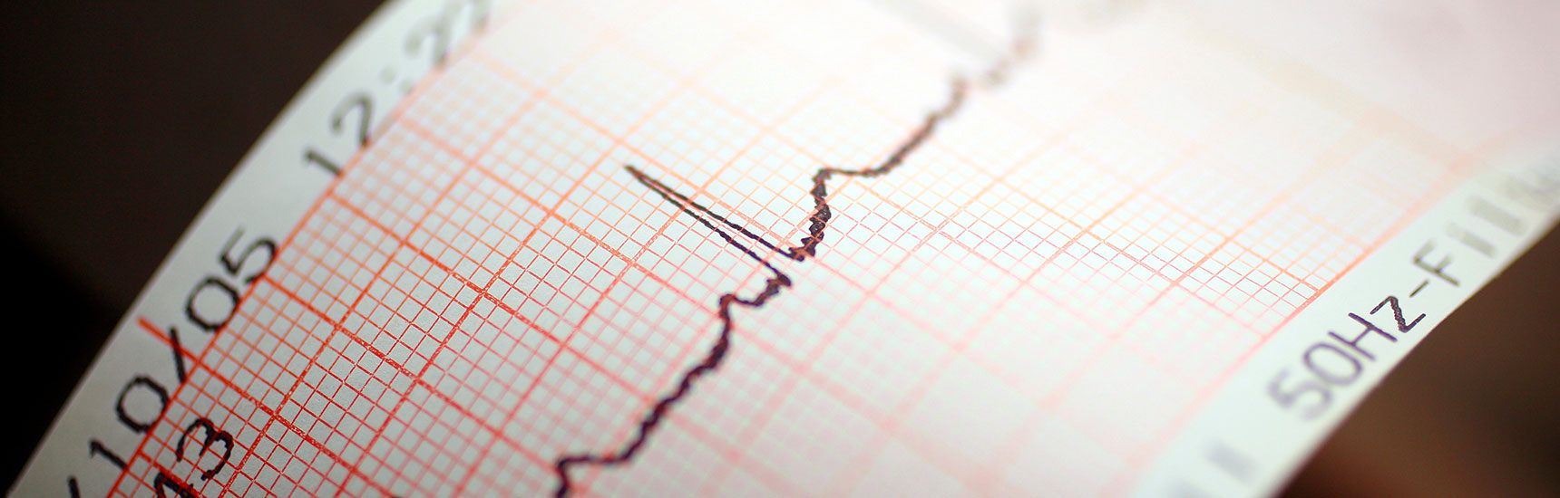EKG - AdobeStock/emeraldfoto