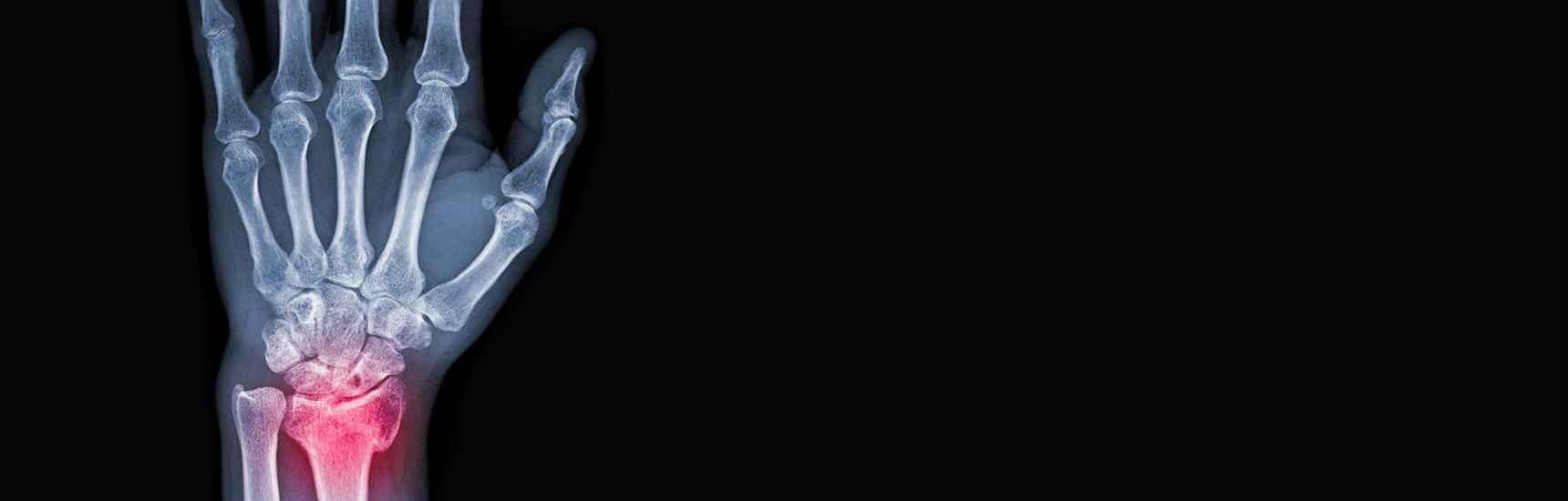 Gelenk - Richman Photo/AdobeStock