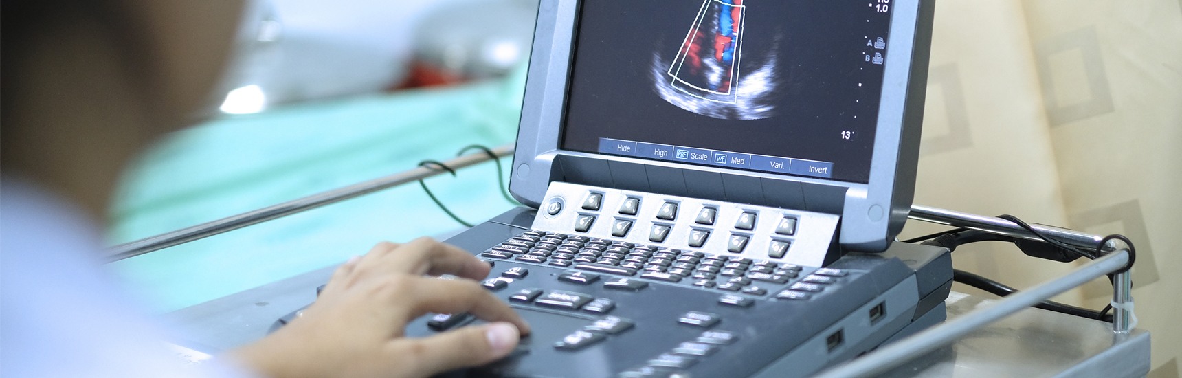 Echokardiographie - adobestock.com