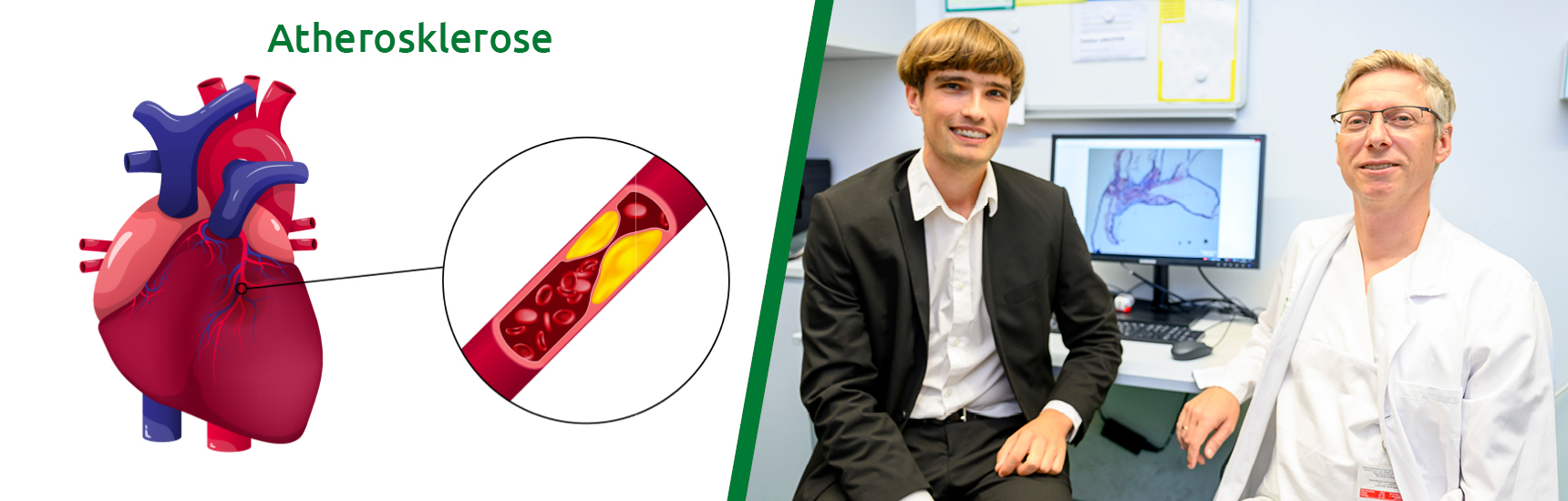 Atherosklerose/Foto:Dee-sign