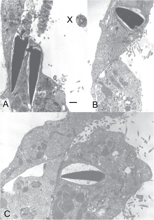 Aufnahmen von eingedrungenen Spermienköpfen in zonenfreie Blastozysten
