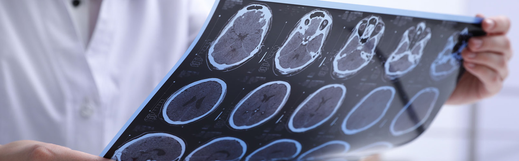 MS ist bislang nicht heilbar - Foto: New Africa/AdobeStock.com