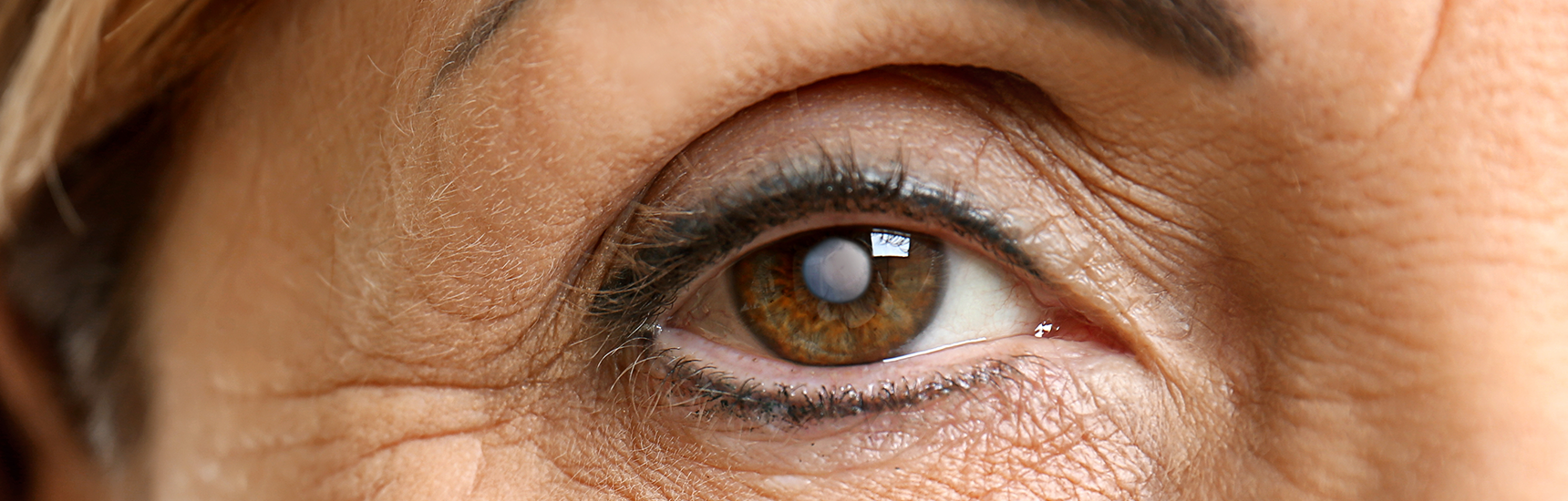 Grauer Star / © Africa Studio/adobe.stock.com